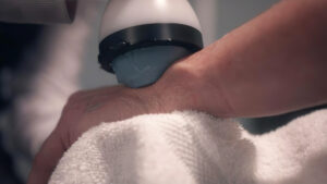 Dr Ravi - Stem Wave Therapy 10 (0-02-44-06) - Wrist StemWave therapy applied to a patient's wrist